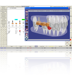 Windent Gestionale per Dentisti